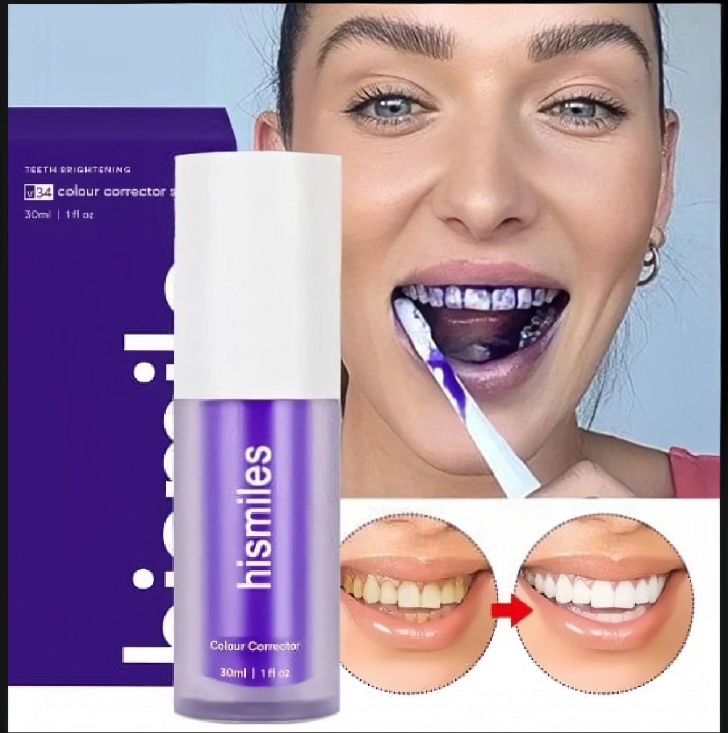 Hismile Theeth whitening